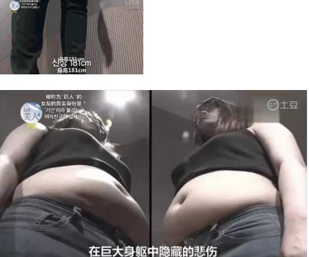 韩国整容手术恢复过程,韩国一个整容的综艺节目