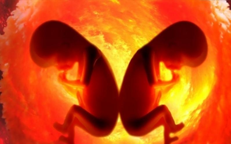 孕早期多久做一次b超比较合适,孕期一共要做几次b超合适