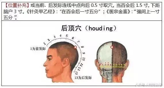 头部穴位中医必背100个知识,穴位脱发
