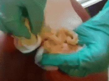 扰人的痘痘问题,你都可以解决!