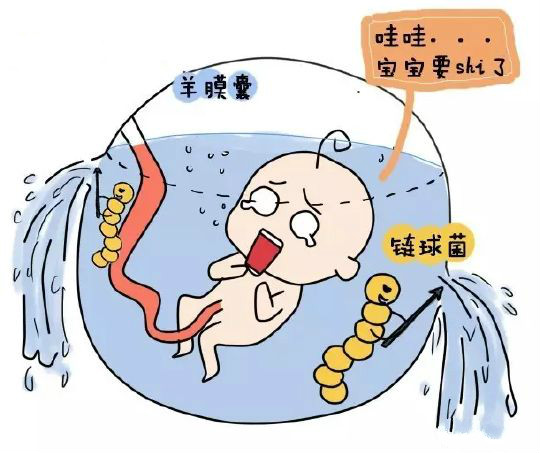 37周就破水了什么时候开始宫缩,31周有没有可能高位破水