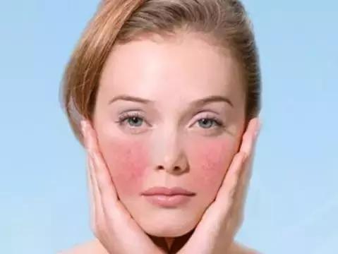 蒸脸器使用有危险吗,蒸脸器有危害吗