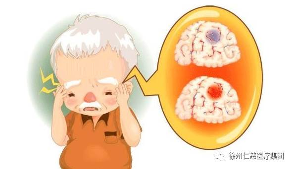 脑梗错过溶栓最佳时间怎么治疗,突发脑梗8小时之内溶栓有影响么