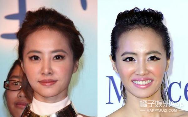 笑容引起的法令纹怎么解决,明星淡化法令纹最简单方法