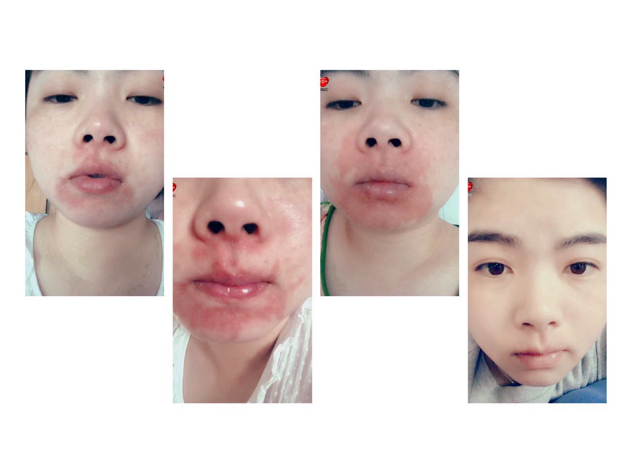 刘艳青护肤必读—肌肤出现代谢怎么处理