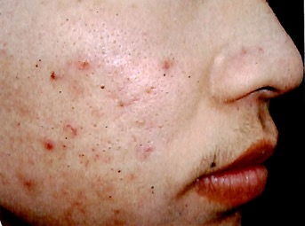 皮肤病解说大全,皮肤病大全书籍