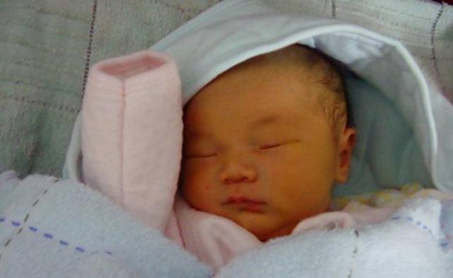 7天婴儿黄疸偏高需要怎么注意,母乳性黄疸妈妈饮食需要注意什么