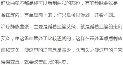 精索静脉曲张艾灸灸哪个穴位,静脉曲张可以艾灸足三里吗