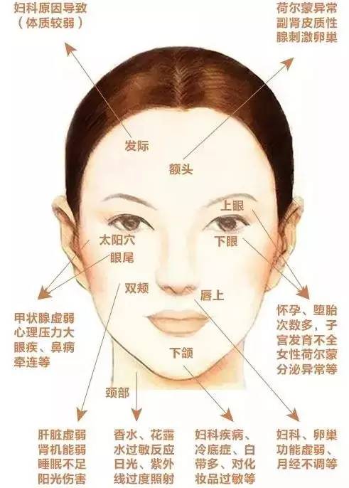 我满脸全是雀斑怎么办,满脸雀斑的我蜕变说说