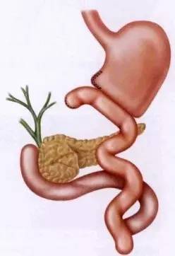 胃镜预处理流程,胃镜内镜手术全流程