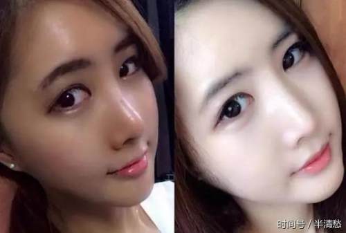 晒黑了如何在一周内白回来,还在为晒黑发愁教你一招轻松搞定