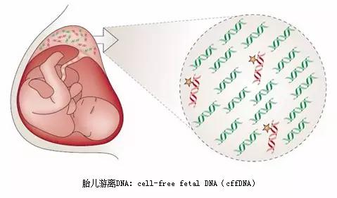 孕妇产前唐筛检查注意什么,孕妈产前都要做什么检查