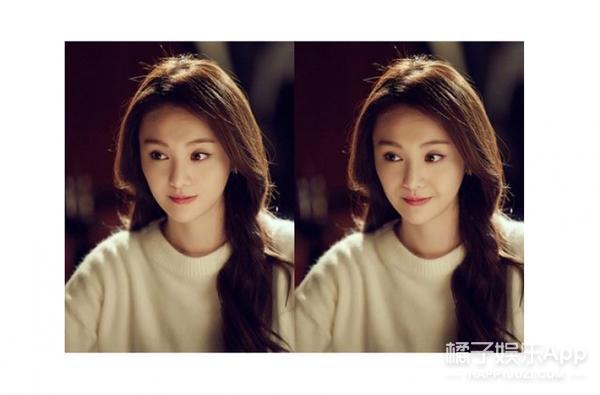 法令纹显老明星,明星怎么治法令纹