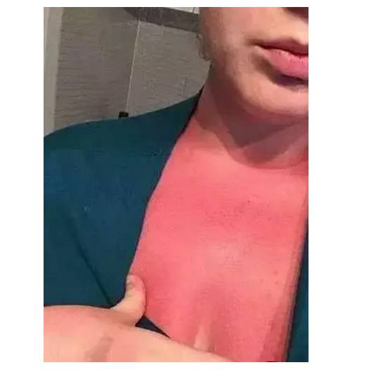 去西北旅游防晒乳推荐哪款好,进藏防晒有用吗