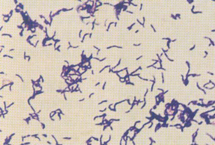 怎样才能祛痘去黑头去闭口,祛痘去黑头粉刺闭口