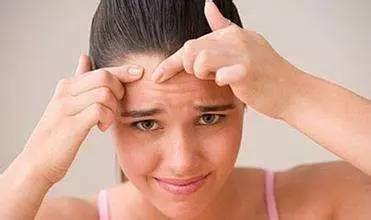 额头长痘期间应该注意些什么,额头长痘痘留下的疤怎么办