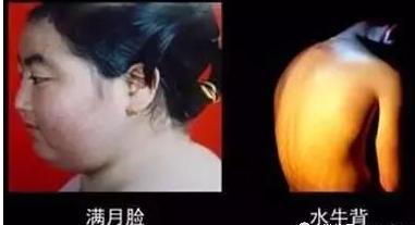 过敏性紫癜吃激素有哪些副作用,过敏性紫癜吃激素的副作用