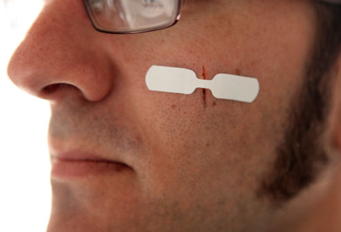 意外烫伤的最佳方法,小心烫伤手怎么办