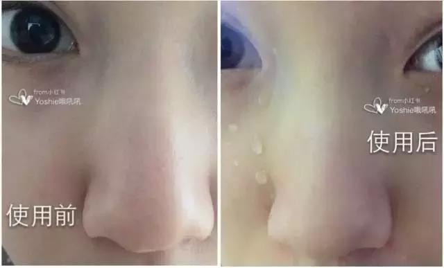 公认口碑最好的水乳护肤品推荐,口碑最好十大精华水乳