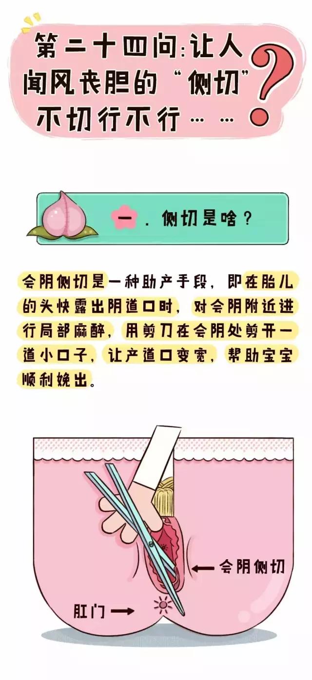 要不要做侧切,侧切过下一次也要侧切吗