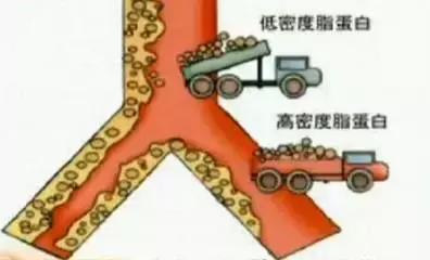 隐形杀手高血脂症,高血脂症到底是怎么形成的