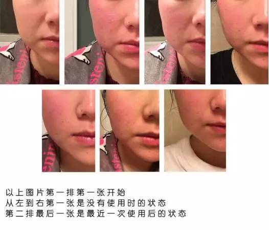 兔妈分享丨价格好爆！以色列Tripollarstop童颜机Luna洁面仪电动硅胶牙刷，吃土都值得入！