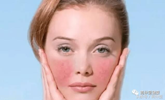 进空调房就脸部发热发红,冷热交替脸部发红发热