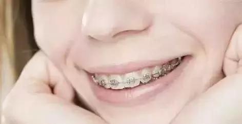 小孩牙齿缝隙大是什么原因,40岁女性牙齿缝隙变大是什么原因