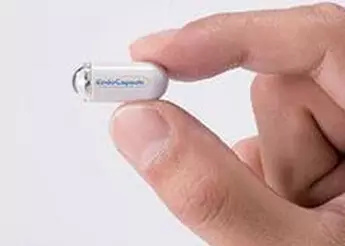 胃镜全过程科普,做胃镜的六大知识