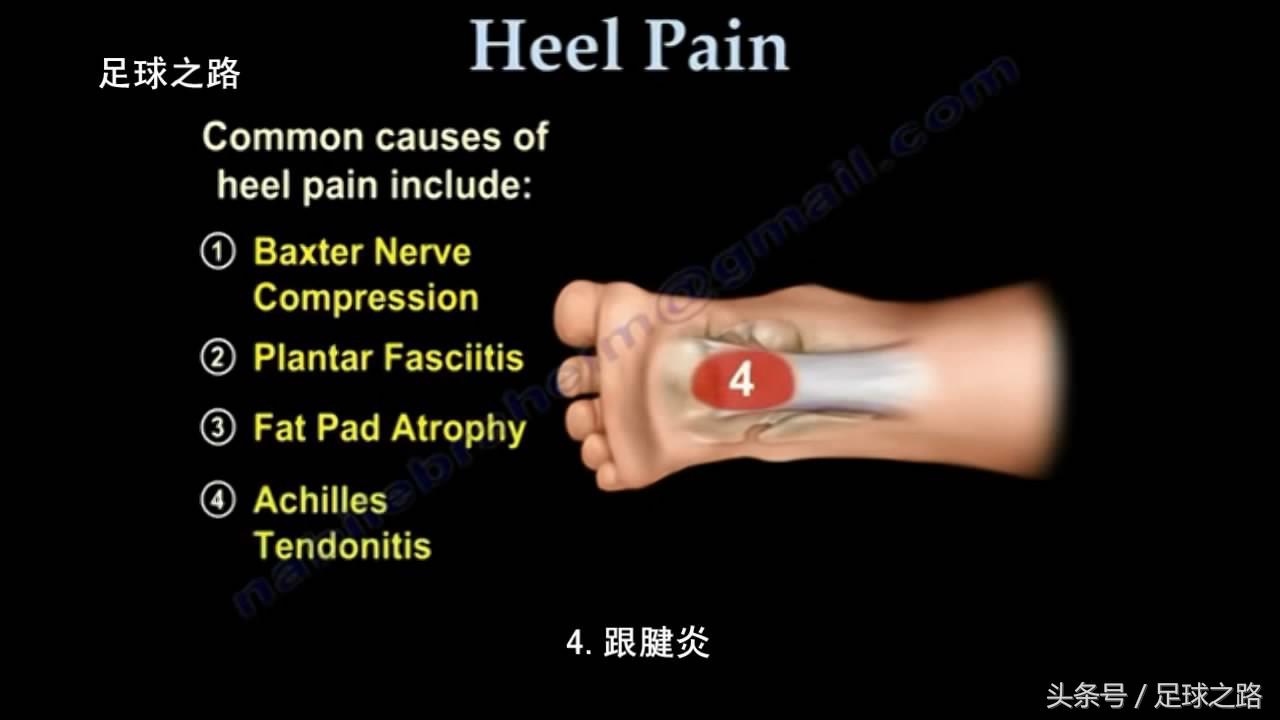 足跟痛最常见病因,足跟痛警惕四种疾病