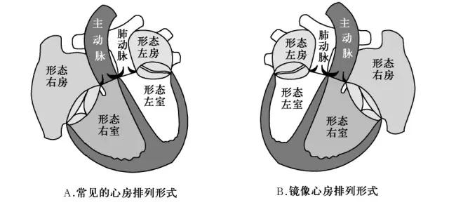 超声肺动脉瓣示意图,肺动脉左右分支超声视频