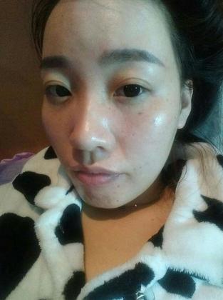 妈妈为女儿消脸上疤,妈妈为了孩子不容易