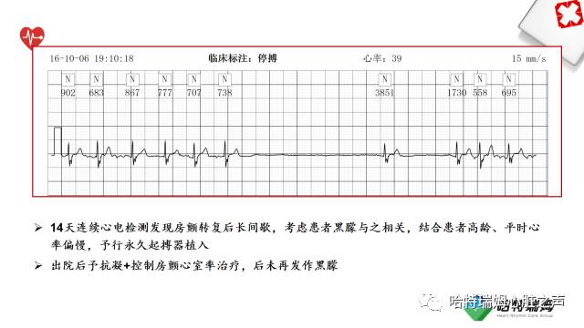 「心声」长程心电检测设备在房颤管理中的重要地位