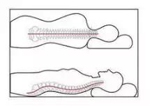 张景明讲颈椎病怎么锻炼,钟南山院士讲治疗颈椎病视频