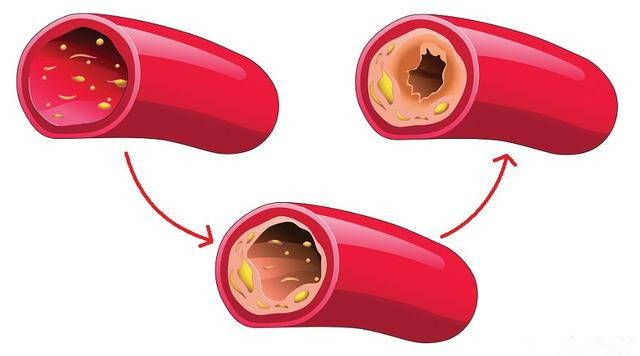 全身突然出现很多小红痣不痛不痒,身上突然长很多小红痣是什么原因