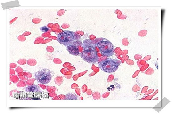 常见妇科肿瘤的诊治与护理答案,妇科常见肿瘤诊治指南第5版pdf