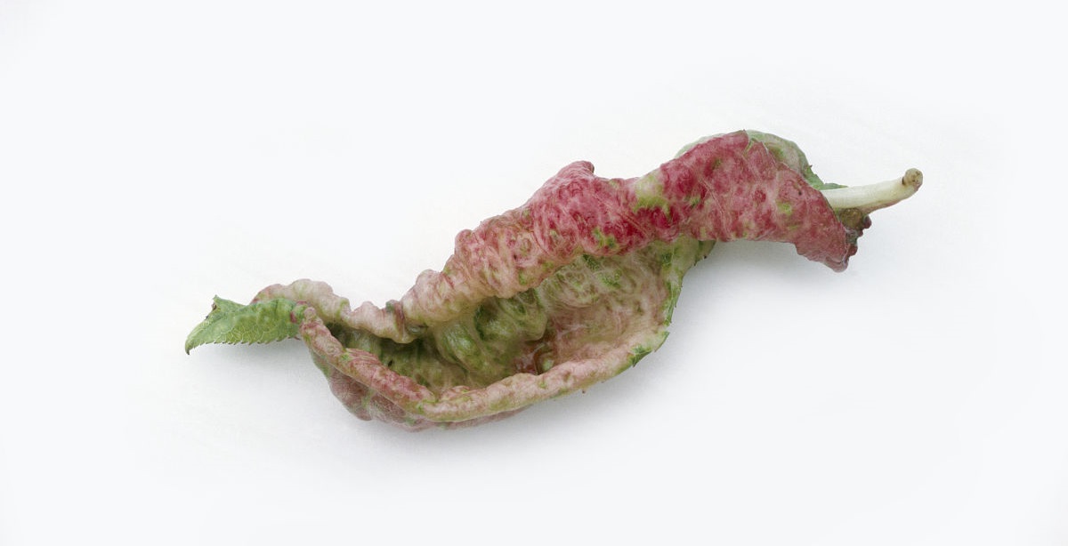 灰指甲是手足癣吗,解析灰指甲的六大临床症状