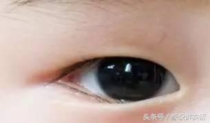 猫咪割双眼皮对比图,猫咪割双眼皮后对比