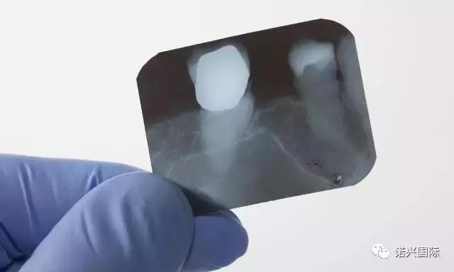 孕妇牙疼可以去看牙医么,孕妇牙疼应该如何治愈