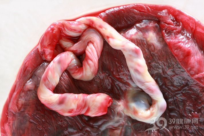 紫河车是人胎盘还是动物胎盘,紫河车和胎盘组织液有区别吗