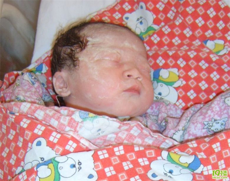 新生儿身上的白色污垢是什么,新生儿白色分泌物如何清理