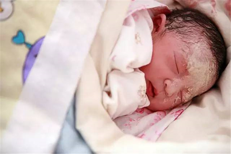 新生儿身上的白色污垢是什么,新生儿白色分泌物如何清理