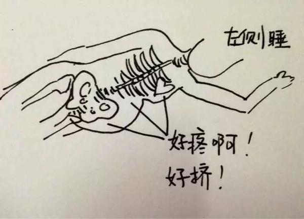 孕中期肋骨疼的不行像岔气,孕中期肋骨疼平躺没事