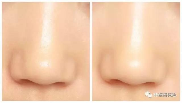 快速让皮肤变水嫩的方法,用鸡蛋怎么让皮肤水嫩嫩的