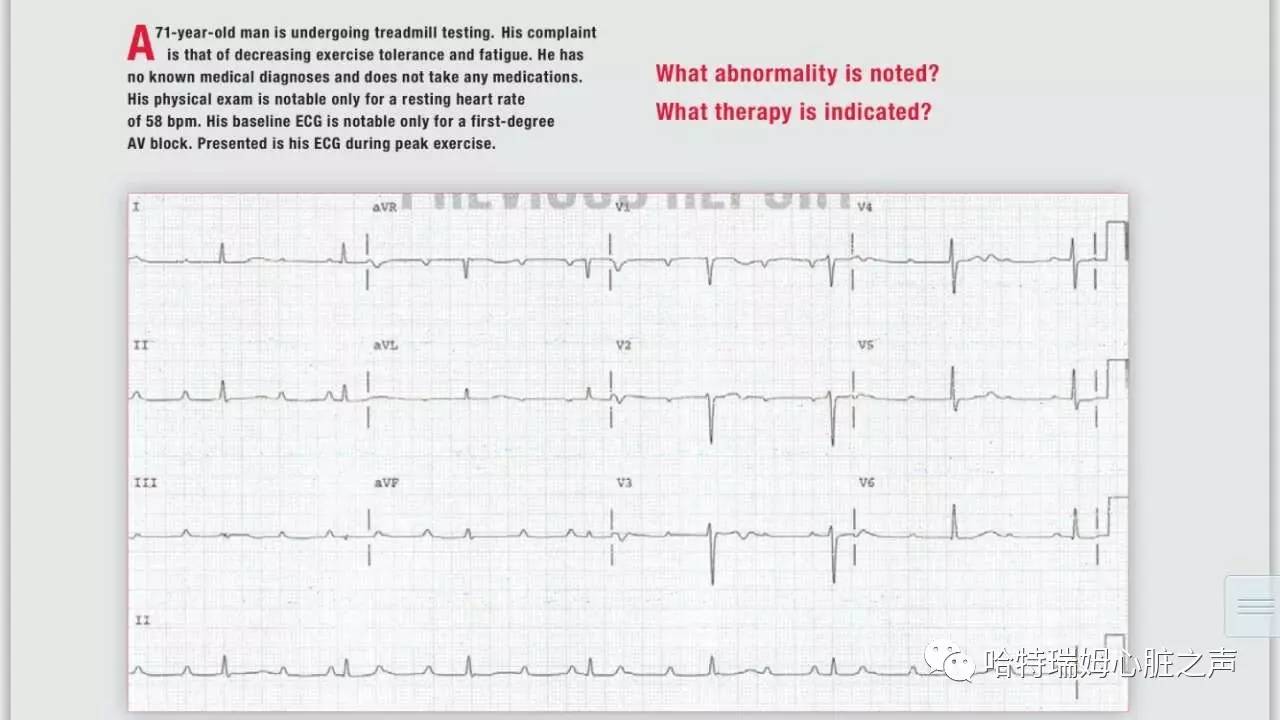 读心有术100期,读心有术视频讲解