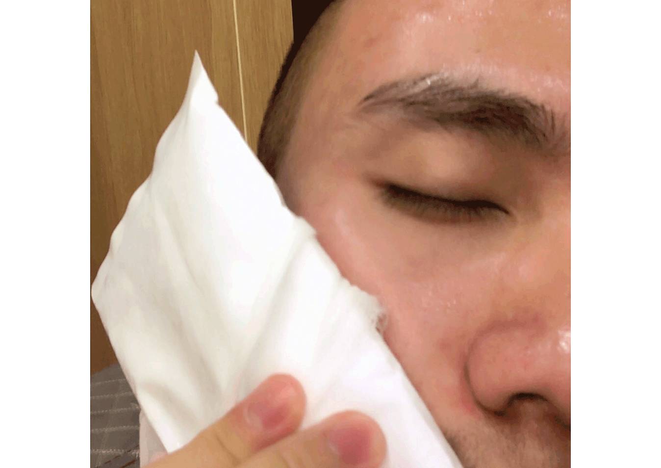 我的祛斑血泪史完整版,我的祛痘史