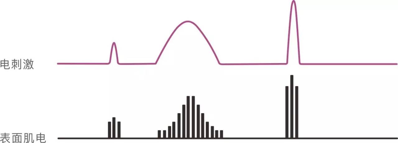 讯丰通xft肌电生物反馈仪,讯丰通第四代电刺激仪