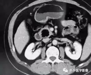 18种疾病包括哪些,18种肿瘤有哪些