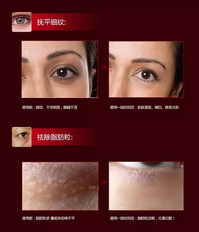 伊思红参蜗牛眼霜怎么用,伊思红参蜗牛滚珠眼霜价格