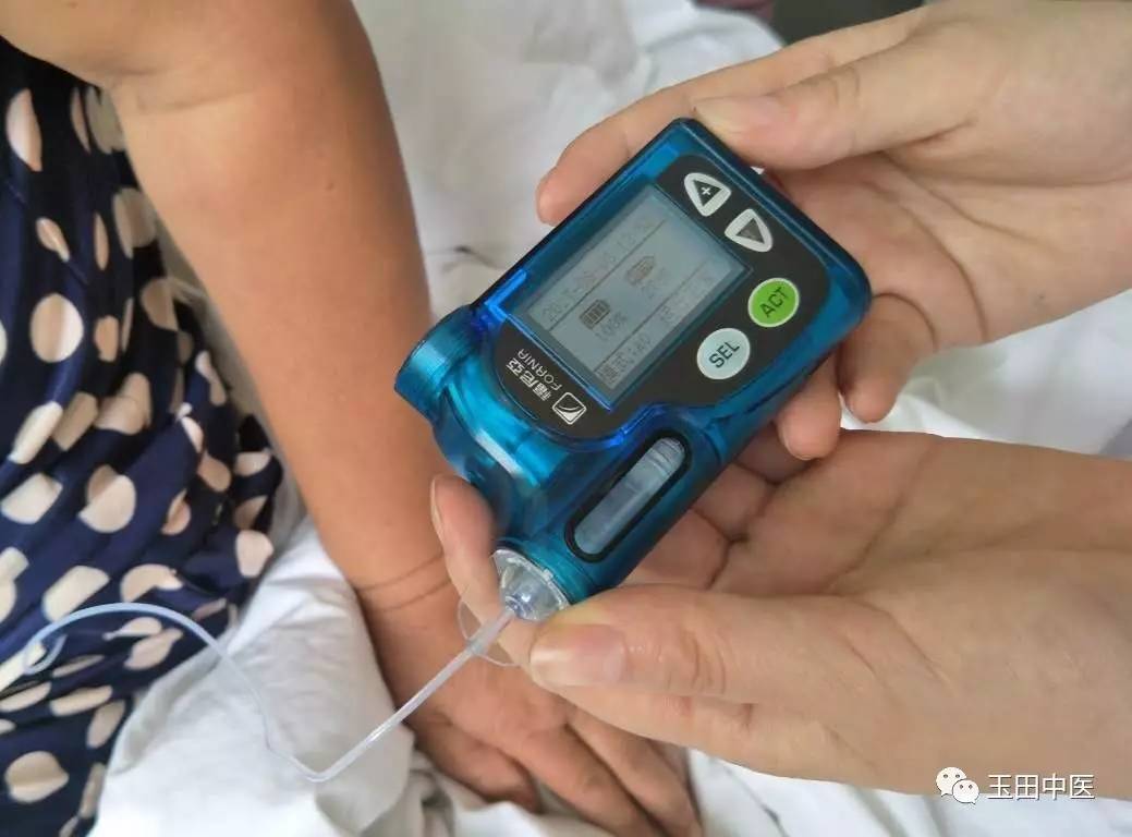 腰挂“BP机”，降糖真神奇！